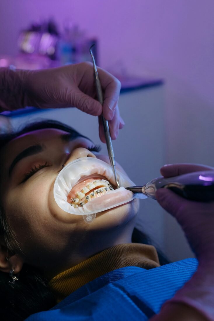 Metal Braces
