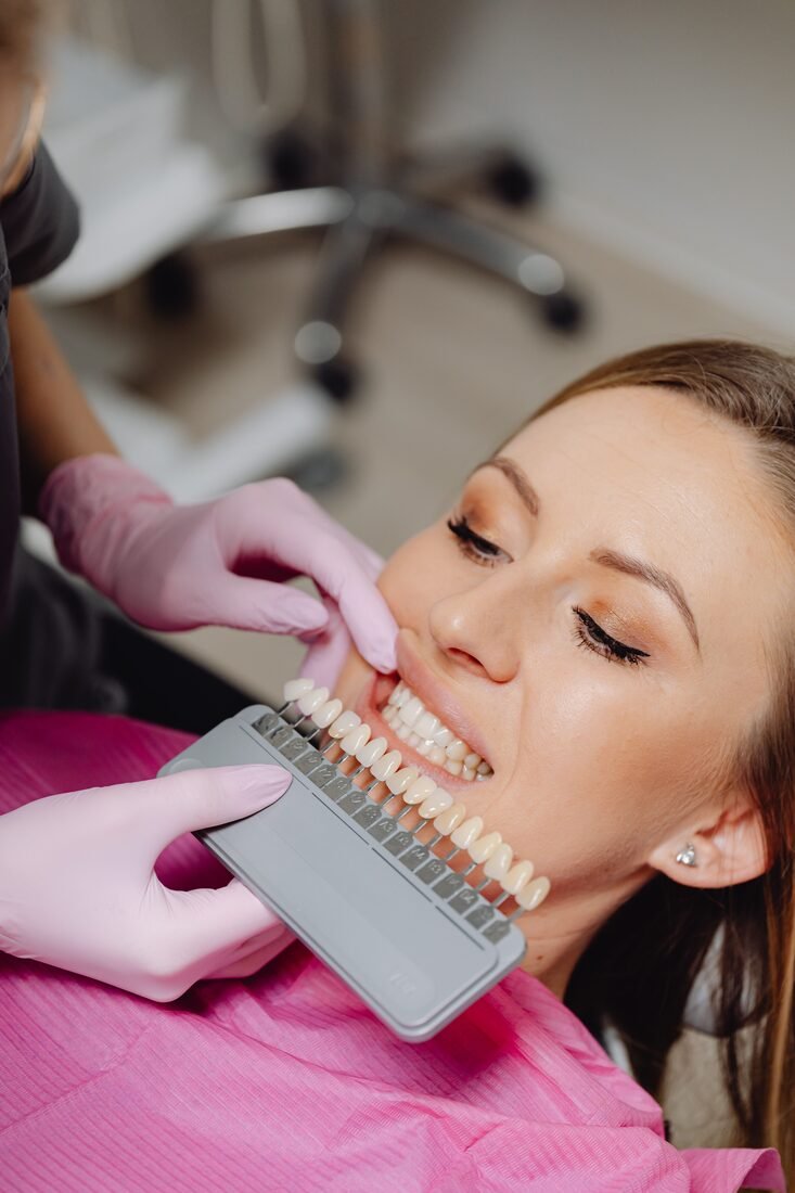 Porcelain Veneers
